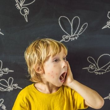 jongen met muggenbeten in het aangezicht met op de achtergrond krijtbord vol met tekeningen van muggen